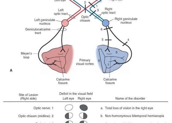 Image reprenant les liens entre champ de vision et innervation de la rétine